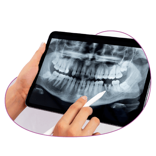 Graphical Dental Charts